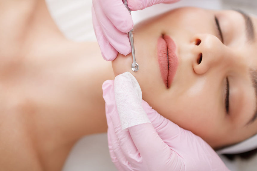 Punti neri: cause e soluzioni efficaci per una pelle pulita